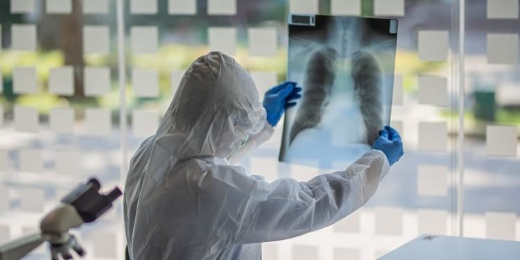 Miturile despre coronavirus se clatină. Ce lucruri interesante au aflat cercetătorii
