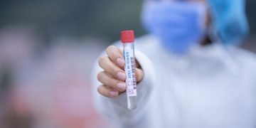 Vreți să plecați în Grecia? Aceasta este lista centrelor unde vă puteți testa